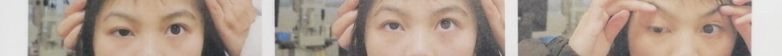 《杨秋艳眼科专家专栏》辗转多地求医未果，南昌爱尔杨秋艳助16岁女生“正”眼看世界